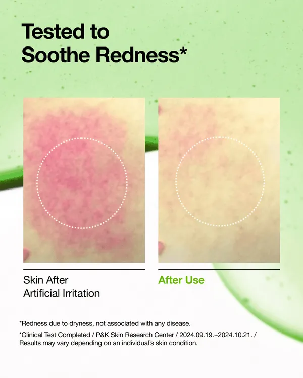 ANUA Azelaic Acid 10 Hyaluron Redness Soothing Serum