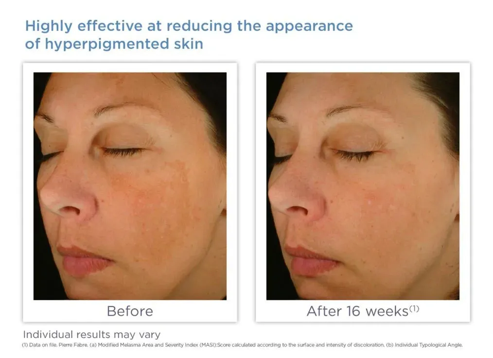 Glytone Enhance Brightening Complex