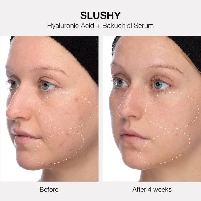 Innbeauty Project The Healthy Skin Edit Bestsellers Kit