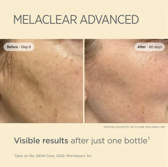 ISDIN ISDINCEUTICS Melaclear Advanced