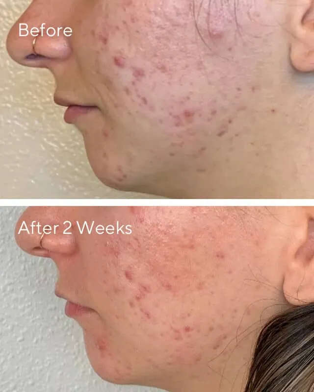 Murad Daily Clarifying Peel