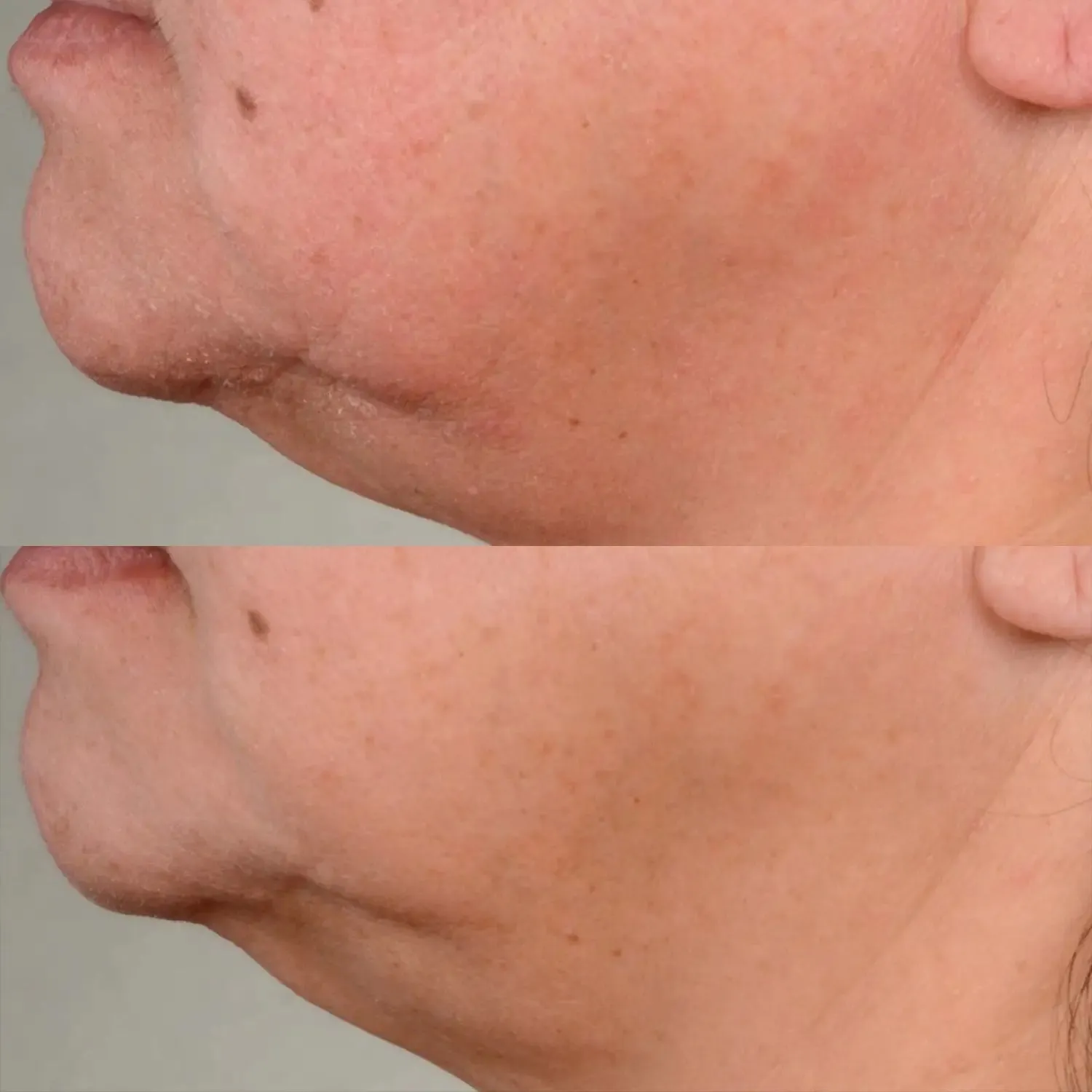 Perricone MD High Potency Firming & Lifting Serum