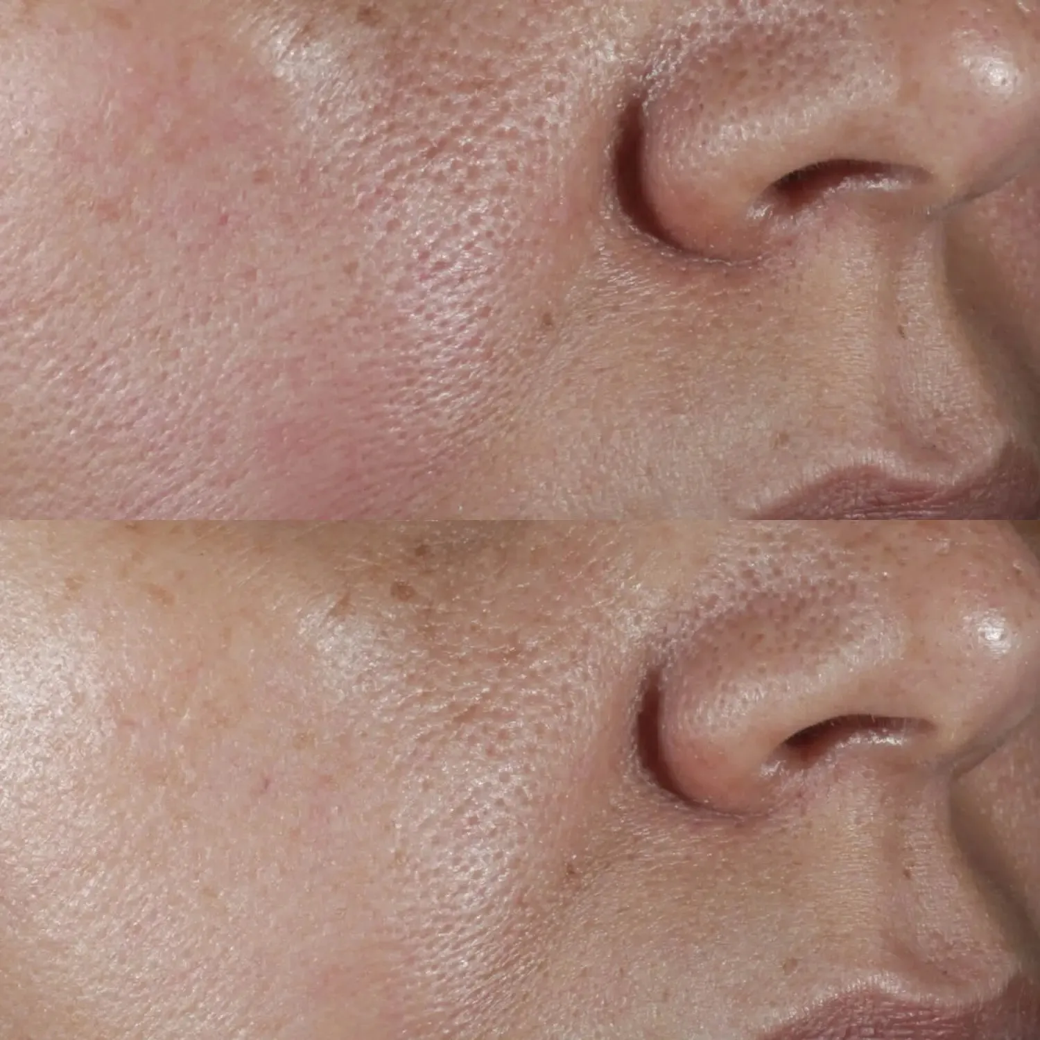 Perricone MD No Rinse Pore Minimizing Toner