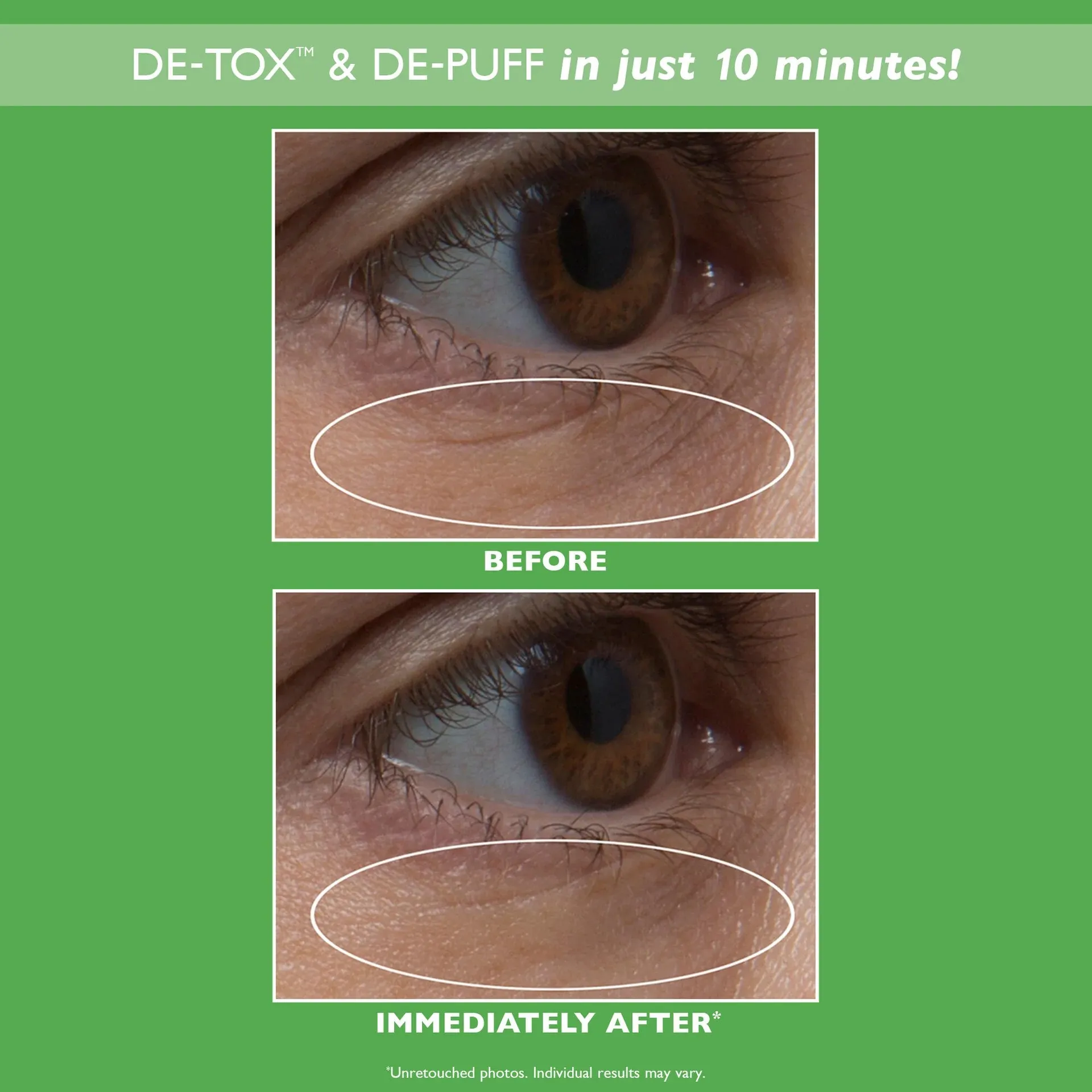 Peter Thomas Cucumber Hydra Gel Eye Patches