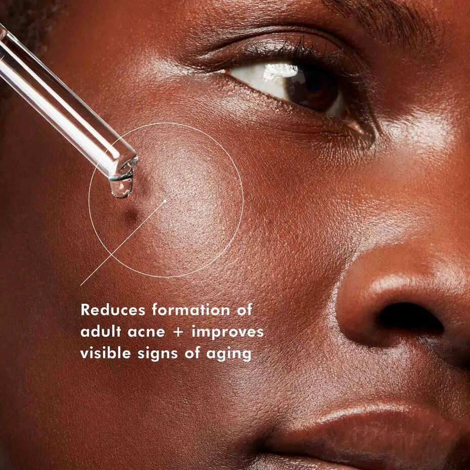SkinCeuticals Blemish   Age Defense