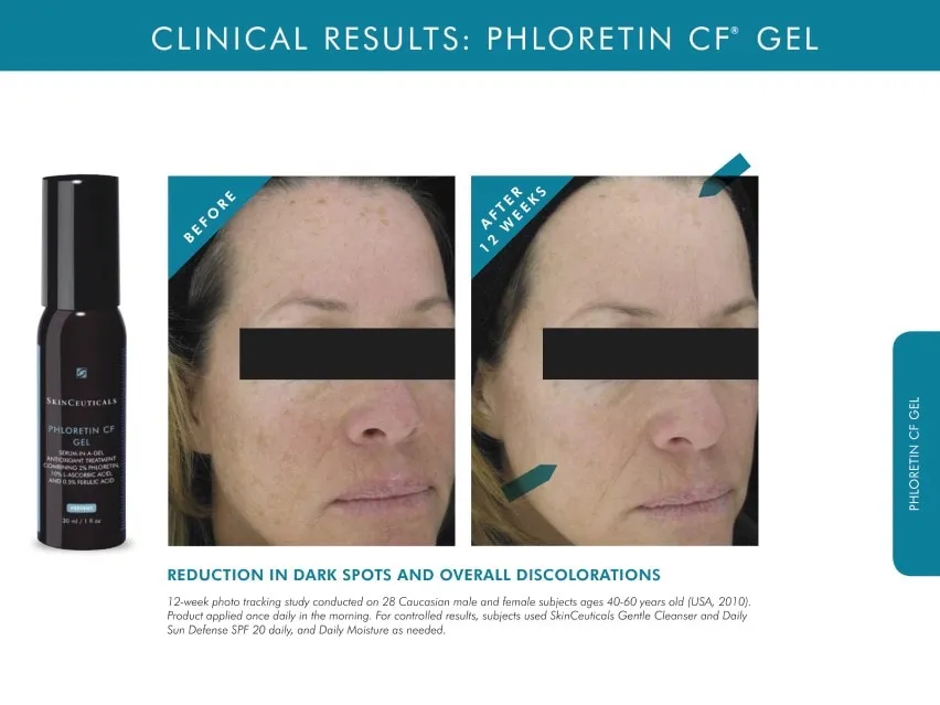 SkinCeuticals Phloretin CF Gel