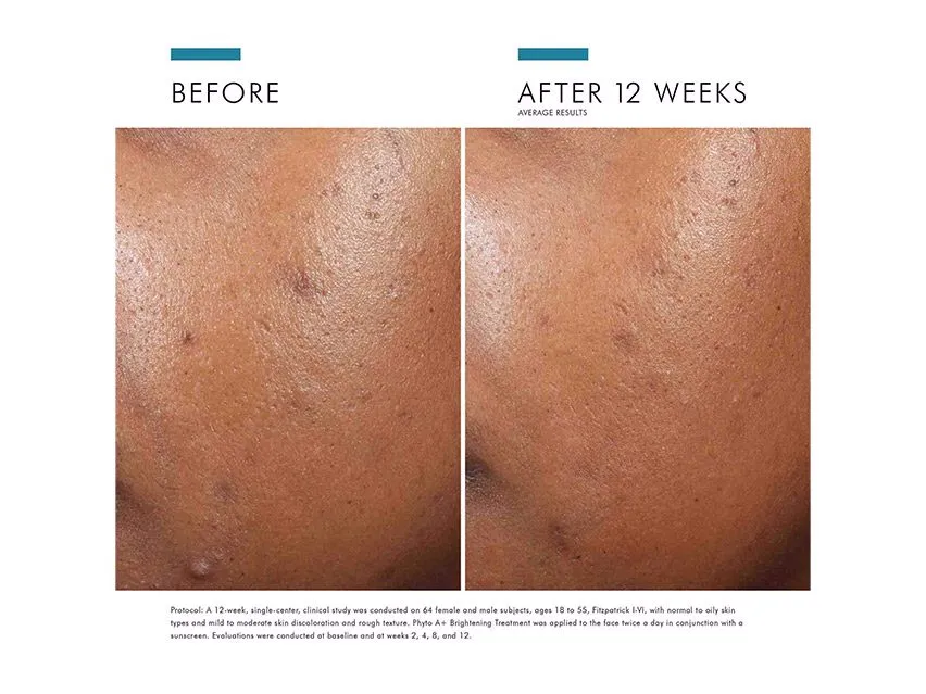 SkinCeuticals Phyto A  Brightening Treatment